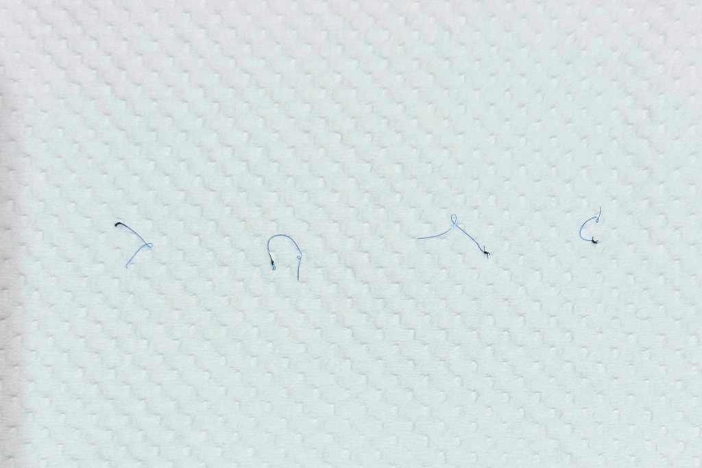 抜糸した埋没法の糸